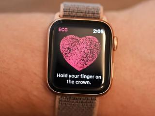Hướng dẫn cách đo ECG điện tâm đồ trên Apple Watch chính xác dễ dàng