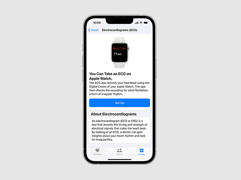 Lợi ích khi đo điện tâm đồ ECG trên Apple Watch